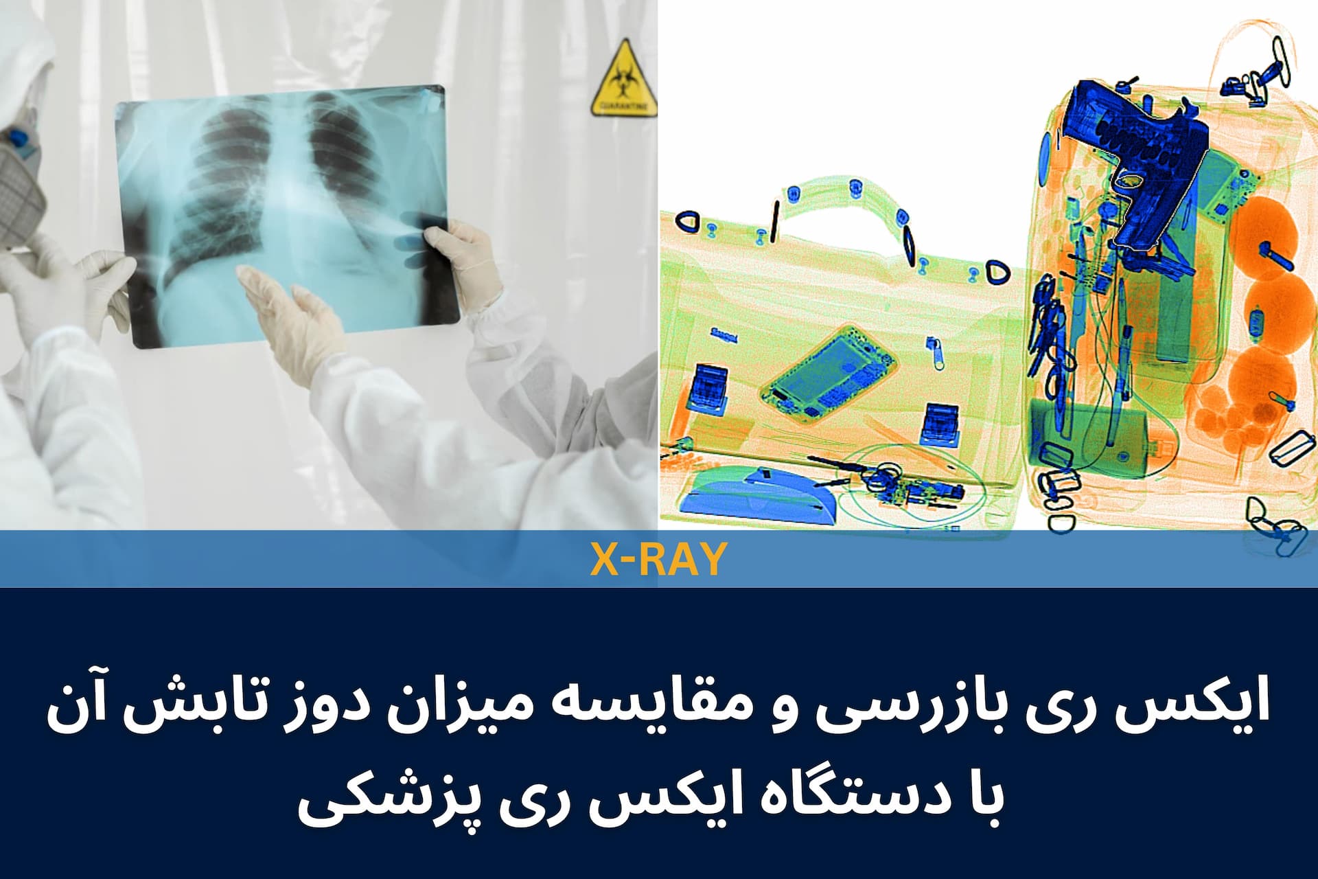 ایکس ری بازرسی و مقایسه میزان دوز تابش آن با دستگاه ایکس ری پزشکی