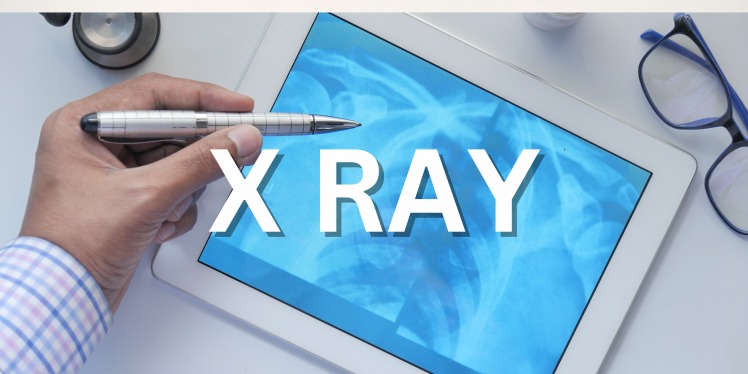ایکس ری (X-RAY) و 30 کاربرد اشعه ایکس در صنایع مختلف